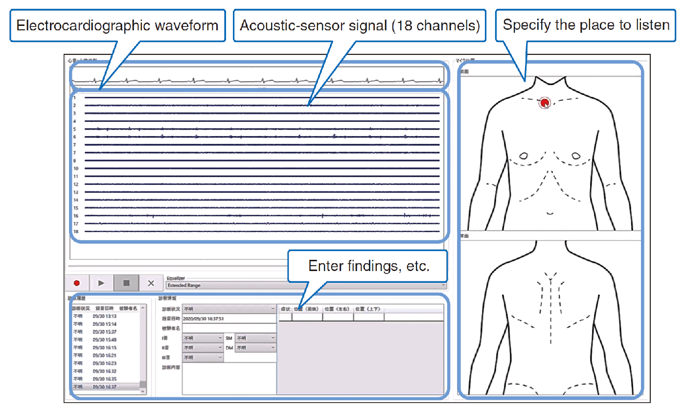 Fig. 2. Screenshot of receiving tablet of telestethoscope.